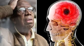 Stroke: Taking two vitamin supplements together could hike your risk of stroke by 17%